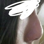 [댓글부탁해] 나 코 <b>필러</b> 맞아야할까?