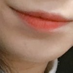 [댓글부탁해] 애들아 나 턱<b>필러</b> 맞았당