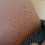 나 때 <b>개</b> <b>쎄개</b> 밀었는데;(혐