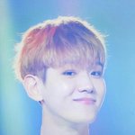 [EXO] 또 성형<b>수술</b>한 창남 백현