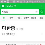 [드루와] 다한증 진짜 개뚜까패고싶다