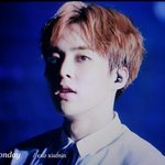 [EXO] 화이트<b>태</b><b>닝</b>