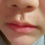 피부에 이거 뭐야?