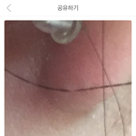 머리카락이 귀뚫음 스불...