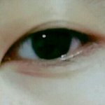얘들아 나 쌍수할까??