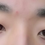 남잔데 <b>눈성형</b> 할까말까?