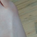 얘들아 <b>발</b> 삐끗했는데 들어와줘ㅠㅠㅠ