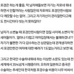 [19] 요즘 <b>포경</b>얘기많은데 솔직히 말하자면