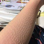 혐주의)미친 내 팔 왜<b>이래</b>