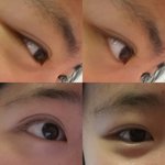 [댓글부탁해] <b>쌍액</b>으로 쌍꺼풀 생겼는데