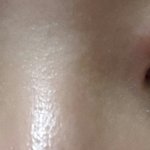[드루와] 나자고일어났는데 <b>눈</b>이 <b>이</b>렇게돼써우뤠ㅠㅠㅠㅠㅠㅠㅠㅠㅠ
