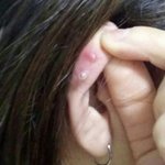 나 귀 막혔는지 안막혔는지 판단좀ㅠㅠ사진있어