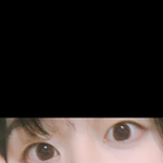 쌍수 한다 <b>or</b> 안한다