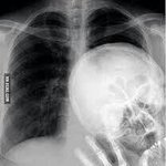 아 ㄹㅇ <b>미세</b>먼지때문에 피부 개빡친다