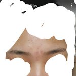 [EXO] 여드름 한달동안 <b>T존</b> 없앤 방법