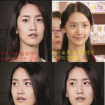<b>윤아</b> 성형뻬박