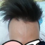 [꼭조언부탁] 여친의 <b>이마</b>