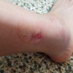 [톡톡] 최근 모 방송에 출연한 한의사에의한 피해자입니다ㅠ