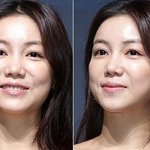 김옥빈 너무늙었네요