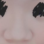 저 성형 고민 입니다. <b>방</b><b>탈</b> 죄송합니다