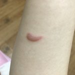 나 다리미<b>화상</b>