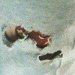 [댓글부탁해] ㅅㅂ나 넘어져서 체육복바지 <b>구멍남</b>