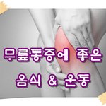 따뜻한 날씨로 활동 늘어나는 봄철에 급증하는 관절염!