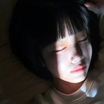 지루성 피부염 개극혐