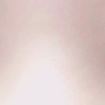 [조언부탁해] <b>짝눈</b> 수술해야돼??