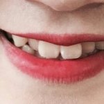 [댓글부탁해] 나<b>하관</b>이정도면 심한건가.. 사진있어