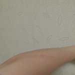 [조언부탁해] 나 너무힘들어서 <b>자해</b>하는데