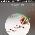 [세븐틴] 벌농이 얼굴에 <b>흉터</b>?
