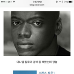 [댓글부탁해] 와 ㅅㅂ 스킨스토마스아는애있어?