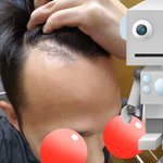 내 <b>이마</b> 어때요