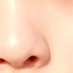 [조언부탁해] <b>코수술</b> 해야할까요ㅠㅠ!!