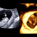 [댓글부탁] 애기 <b>성별</b>구별좀 해주세요!!