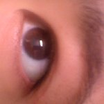 [꼭조언부탁] 쌍수풀린거맞징,,??ㅜㅜ