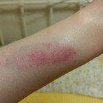추가]전남친과의 싸움 고소..조언부탁드려요 (사진유