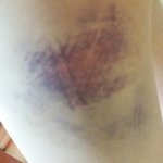 [꼭봐주세요] 공기업이 용역깡패를 300명을 보내 상인들을 죽일...