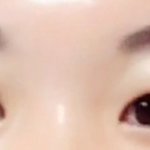 [댓글부탁해] 쌍수결정! 제발 답해줘 ㅠㅠ