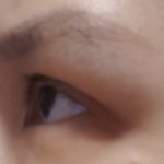 [꼭조언부탁] 쌍수재수술한 눈 좀봐주세요...