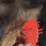 (사진유)(추가) (추가2)동생이 귀가 뜯겼는데 가해자래요