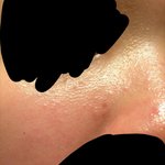 [댓글부탁해] (혐오주의) 피부 <b>요철</b> 이거 어떻게 해야돼?