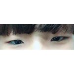 [댓글부탁해] 남자 <b>쌍수</b> 잘된건가여?