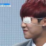 [프로듀스2] 박우진 <b>안대</b> 뒤 피딱지