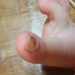 <b>발톱</b>으 까만데 왜이래?