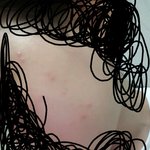 [꼭조언부탁] 하,,눙물ㅠㅠ 피부 다 뒤집었따