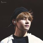 [방탄소년단] 태형이얼굴 <b>흉터</b>