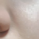 [댓글부탁해] 볼<b>주름</b> 같은거 살쪄서 이런거임?ㅠ
