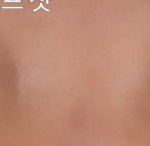 [댓글부탁해] <b>무쌍</b>인데 쌍수해야될까 !!눈좀 봐줘!!!